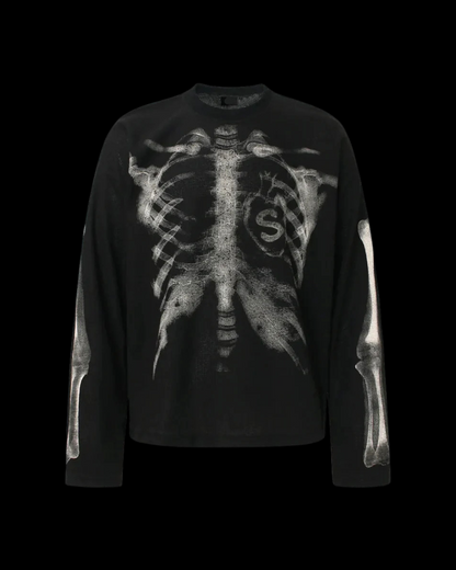 'XRAY' THERMAL